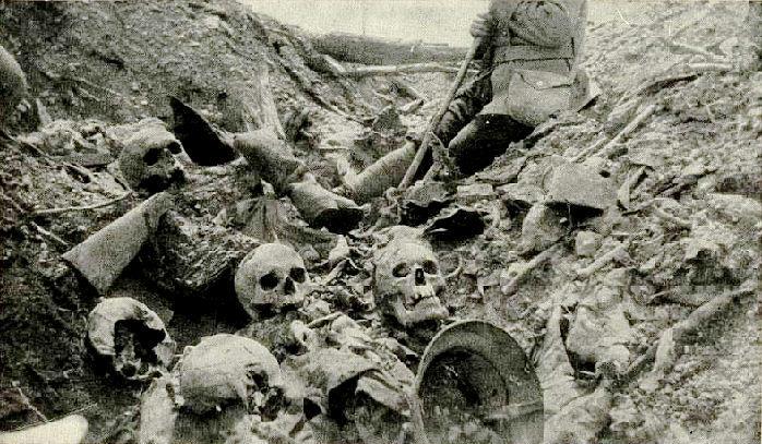 French soldier sits among the remains of German soldiers piled up in the Death Ravine at Verdun.
